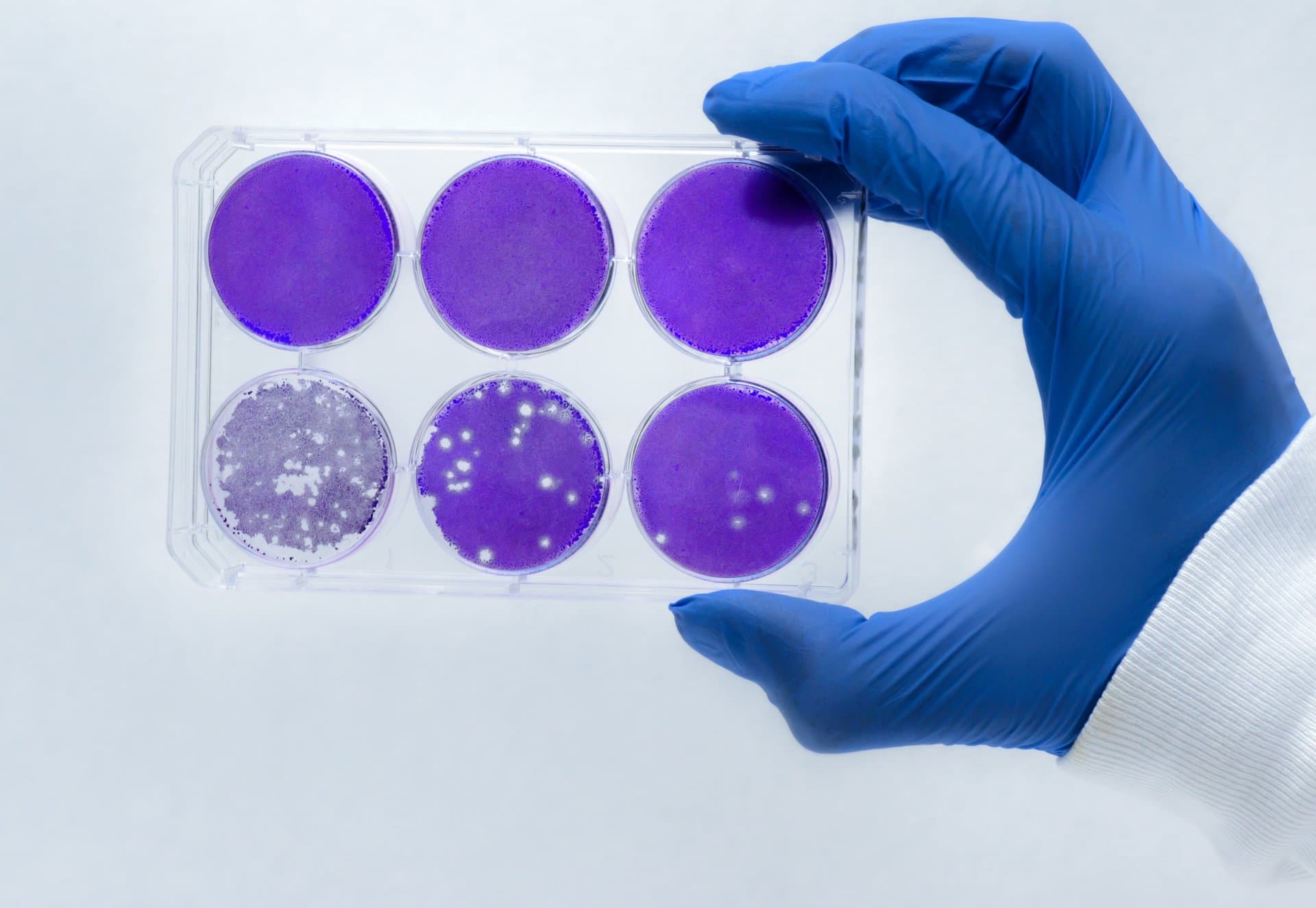 Researcher in blue glove holds a six-well plate showing purple-stained cell cultures with varying colony growth for laboratory analysis.