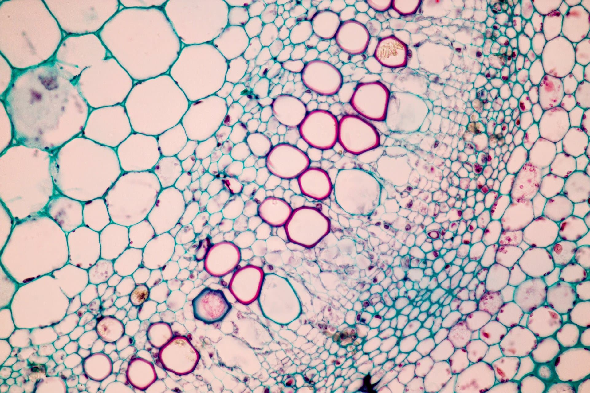 Microscopic view of stained plant tissue cells showing pink xylem vessels and teal cellular structures in a cross-section sample.