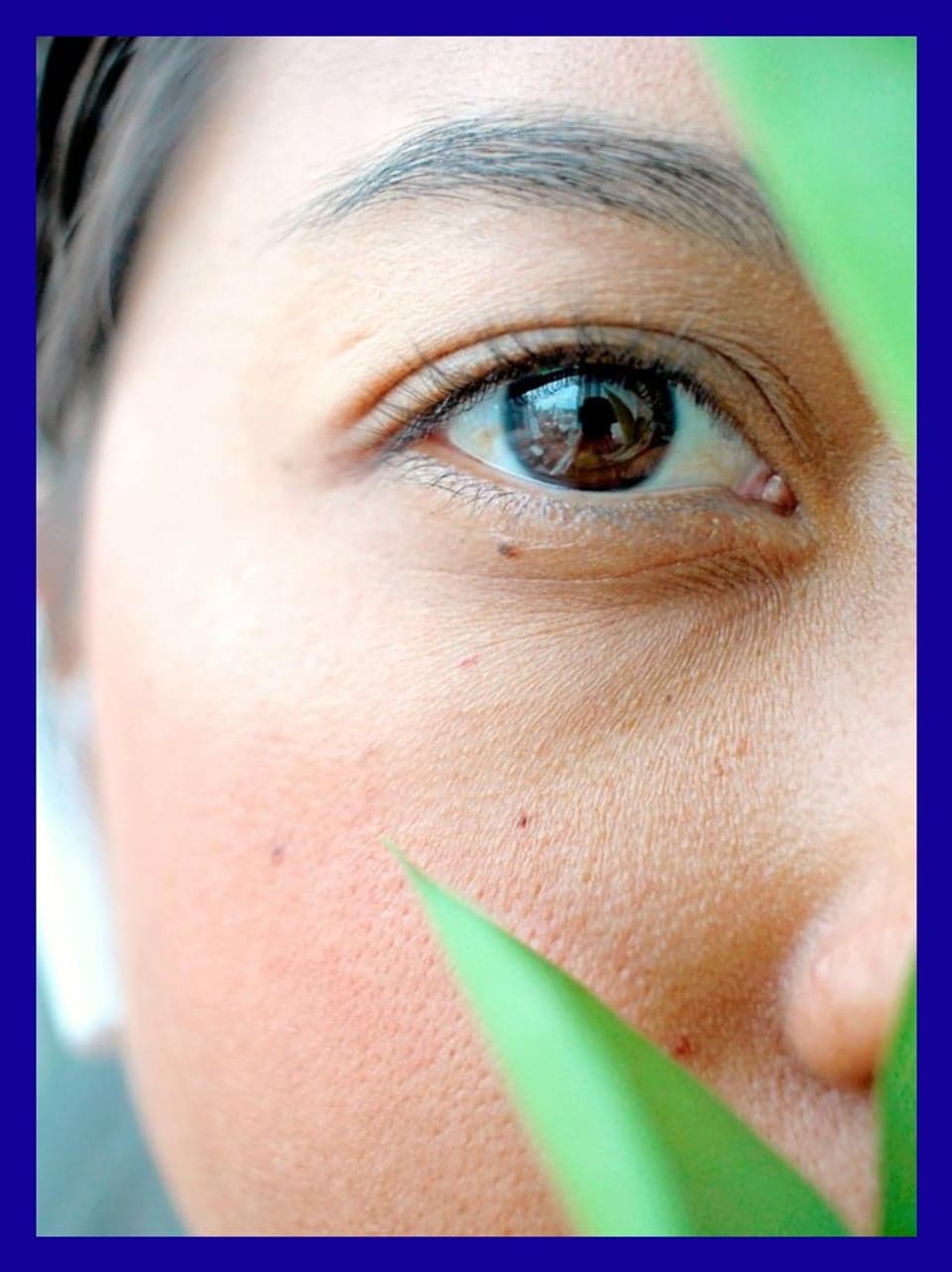 News — TARGET-DERM Real-World Evidence Study Reaches 1,000 Enrolled Participants | Grid