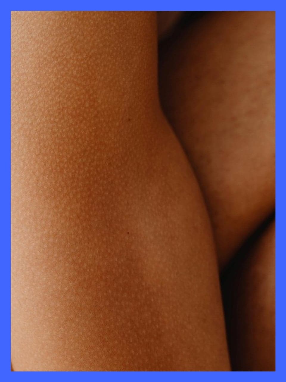 News — TARGET-DERM Real-World Study Success Leads To Global Site Expansion And New Derm | Grid