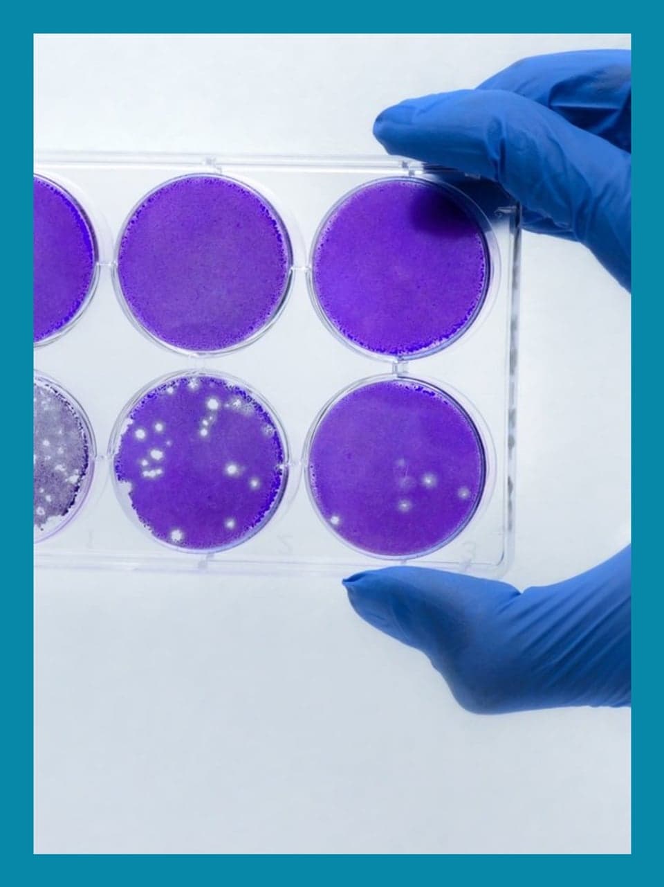 News — An Overview of MASH: Advancements in Diagnosis, Treatment, and the Role of Real- | Grid