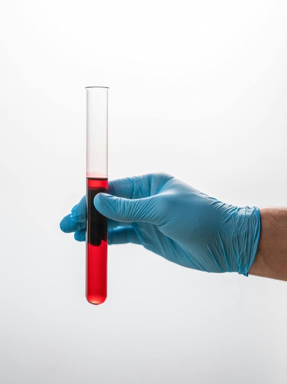 News — TARGET-HCC Initial Manuscript Published in Hepatology Communications | Grid