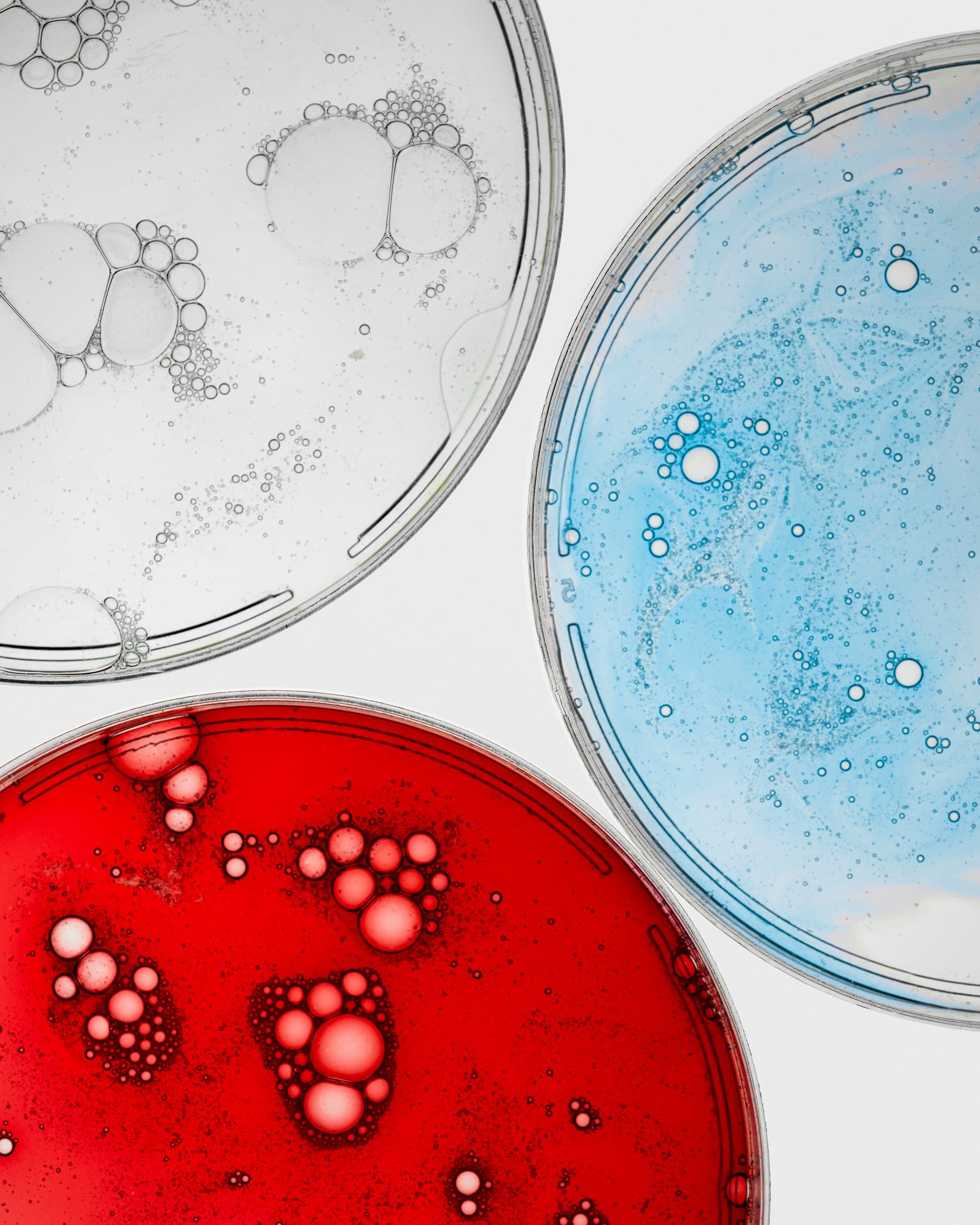 Three petri dishes containing red, blue, and clear liquid samples with bubbles, representing healthcare research and clinical data analysis.