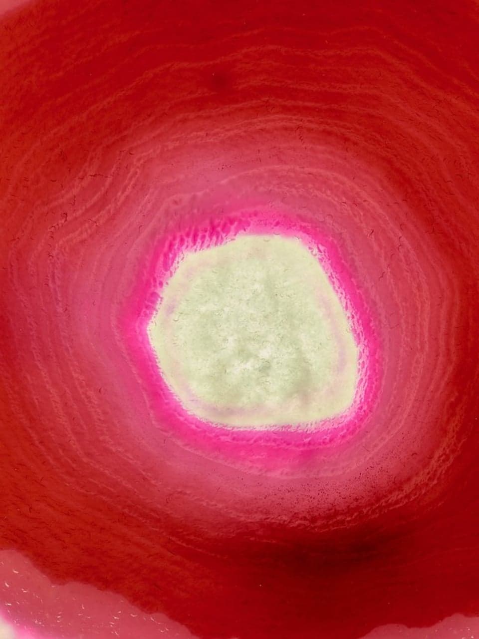 News — New Patient-Reported Outcome Insights from Target RWE: NASH-CHECK Reveals Stabil | Grid